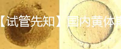 【試管先知】國內(nèi)黃體期方案經(jīng)驗緊缺,2點促排弊端需了解