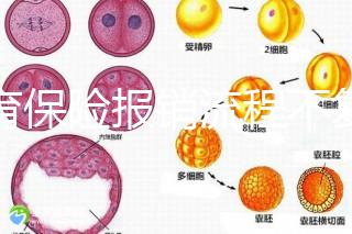 生育保險(xiǎn)報(bào)銷流程不復(fù)雜,辦理地點(diǎn)不分地域異地可報(bào)銷