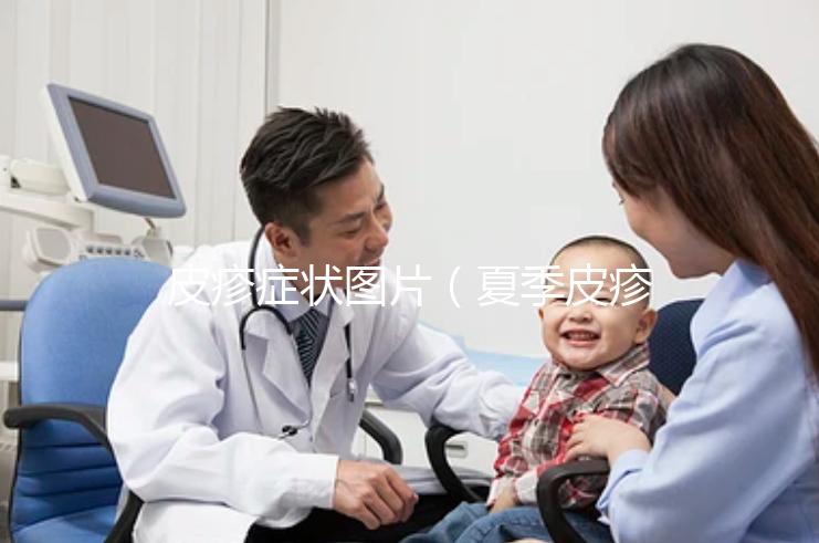皮疹癥狀圖片(夏季皮疹癥狀圖片)