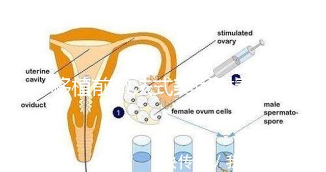 移植前做法式美甲對(duì)著床影響不少,別以為貼甲片就沒(méi)事了