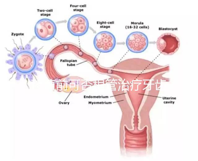 移植前可否根管治療牙齒看情況，這些影響別還不知道