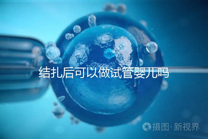 結(jié)扎后可以做試管嬰兒嗎（結(jié)扎后可以做試管嬰兒嗎費用多少錢）