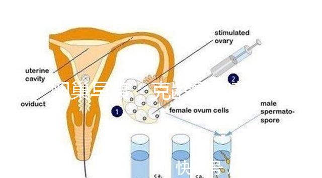卵巢早衰，克齡蒙和芬嗎通藥物選擇引爭議