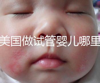 去美國做試管嬰兒哪里最好，4家好評輔助生殖機構推薦