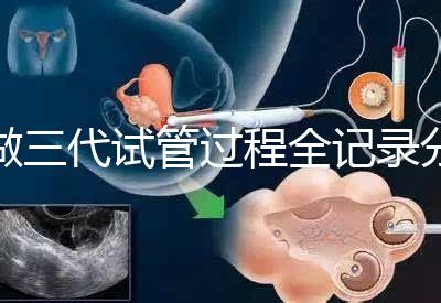 做三代試管過程全記錄分享(北醫(yī)三院)