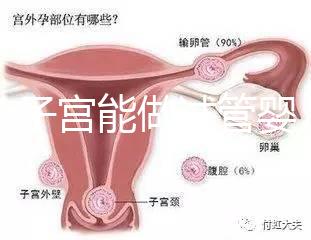 雙角子宮能做試管嬰兒嗎？可以，但這2大條件缺一不可