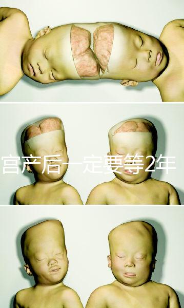 剖宮產(chǎn)后一定要等2年，才能試管嬰兒懷孕嗎？