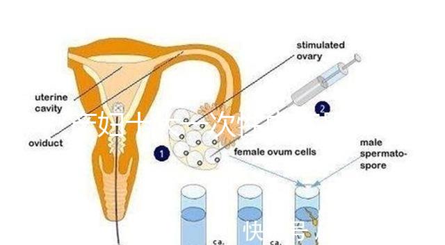 產(chǎn)婦十大一次性內(nèi)褲品牌排行揭曉，全棉時代質(zhì)量如何看這