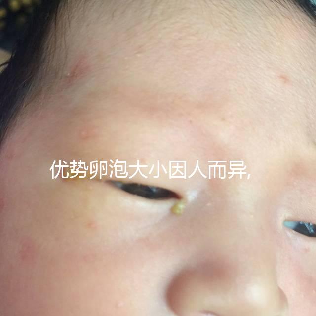 優勢卵泡大小因人而異,醫生表示1.8