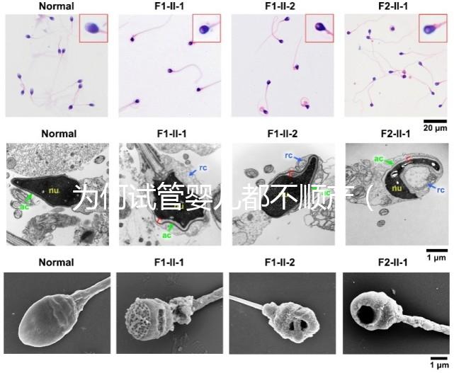 為何試管嬰兒都不順產(chǎn)（為何試管嬰兒都不順產(chǎn)呢）