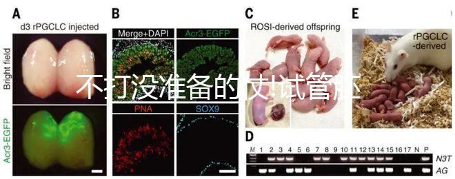 不打沒(méi)準(zhǔn)備的仗!試管胚胎移植前做好這6點(diǎn)才能事半功倍