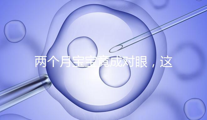 兩個(gè)月寶寶竟成對眼,這5大形成原因家長必知