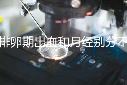 排卵期出血和月經別分不清，4大區別輕松判斷