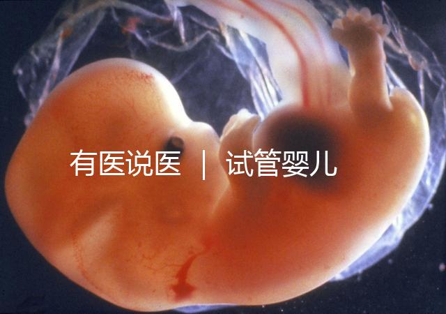 有醫說醫 | 試管嬰兒技術不能避免宮外孕,“三孩”時代警惕宮外孕發生率增加