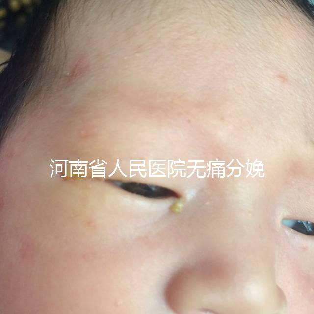 河南省人民醫院無痛分娩多少錢戳，收費標準60s看懂不踩坑