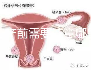 孕婦產(chǎn)前需要注意哪些事項(xiàng)?