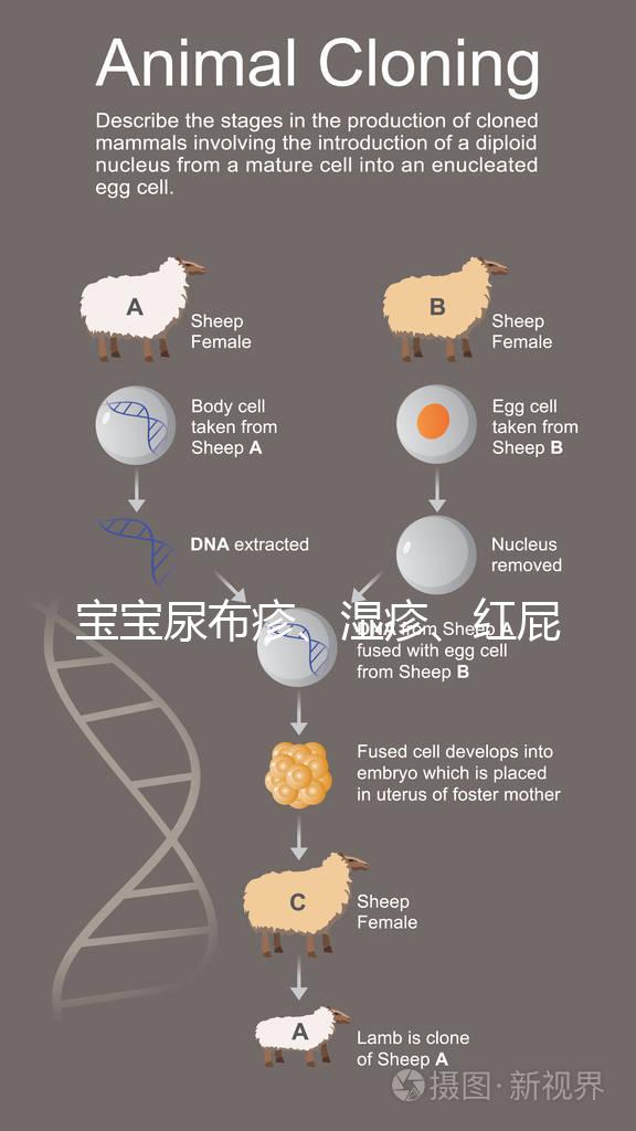 寶寶尿布疹、濕疹、紅屁股傻傻分不清？4點(diǎn)區(qū)別輕松診斷