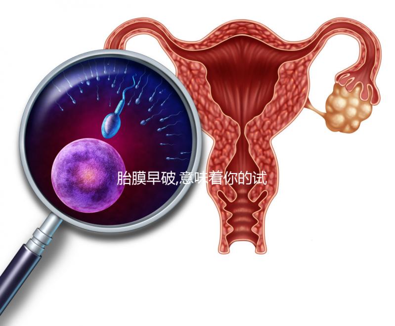 胎膜早破,意味著你的試管嬰兒媽媽夢(mèng)也破裂了？！