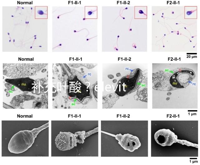 補(bǔ)充葉酸？elevit愛樂維那你不得不了解