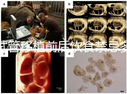 試管移植前后飲食禁忌多，十大不利于胚胎著床的水果別亂吃