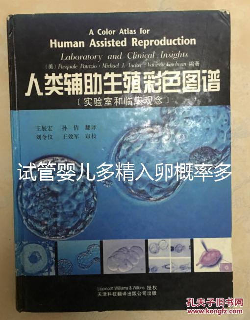 試管嬰兒多精入卵概率多少難說，比正常配對(duì)低別瞎操心