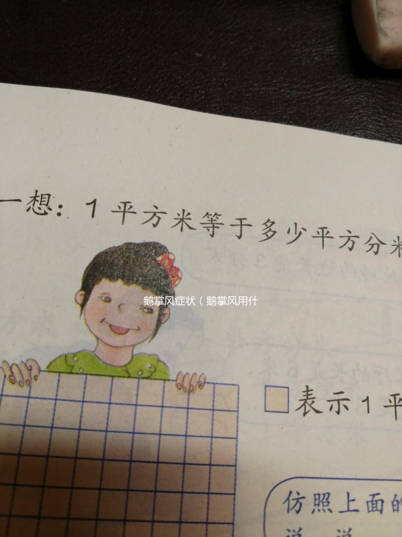 鵝掌風(fēng)癥狀（鵝掌風(fēng)用什么藥根治）