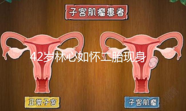 42歲林心如懷二胎現身新活動，霍建華全程陪同產檢回應