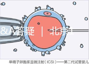 Q&A答疑 | 北京16項(xiàng)輔助生殖技術(shù)進(jìn)醫(yī)保,試管可以報銷嗎?