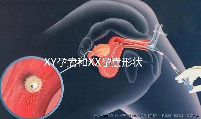 XY孕囊和XX孕囊形狀各有差異，橢圓形可能是懷女哦！