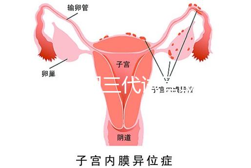 2025昆明三代試管助孕費用一覽，8-15萬元，價格透明公開自主選擇