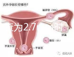 nt檢查為2.7mm時(shí)危險(xiǎn)性莫亂猜，做完無(wú)創(chuàng)后才能確定