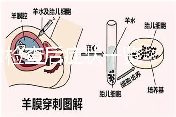 tct檢查后癥狀一覽，專家提醒做好處理措施是關(guān)鍵